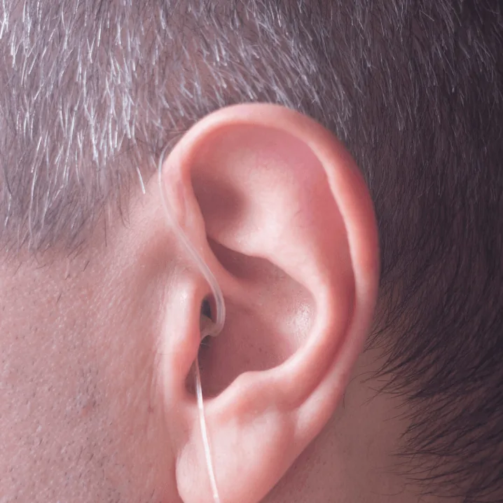 audifono RIE adaptación abierta en oreja